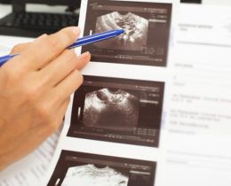 Follicular Monitoring