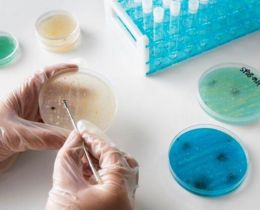 Semen Analysis